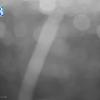 PortSheldonApr152026_ 9hh03mm00ss
